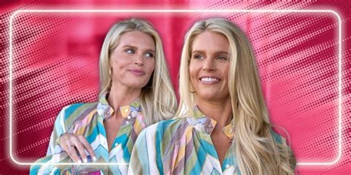 The Southern Charm Cast’s Before And After Pictures Examined; Nose Job & More!